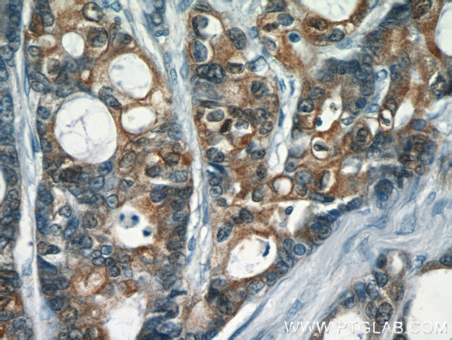 S100A6 Antibody in Immunohistochemistry (Paraffin) (IHC (P))