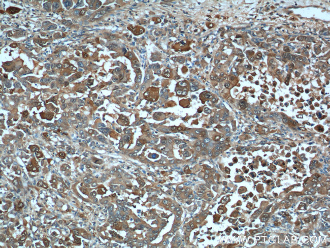 S100A6 Antibody in Immunohistochemistry (Paraffin) (IHC (P))