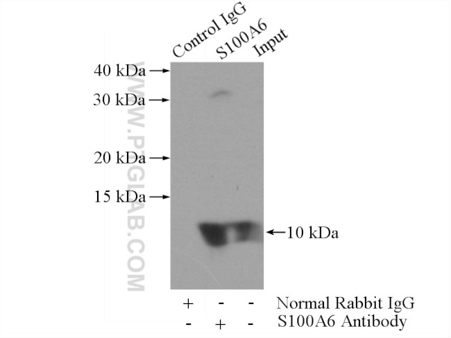 S100A6 Antibody in Immunoprecipitation (IP)