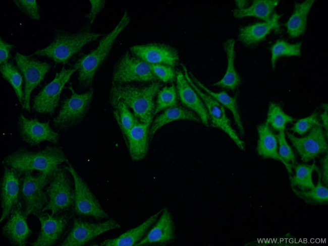 CPLX1 Antibody in Immunocytochemistry (ICC/IF)