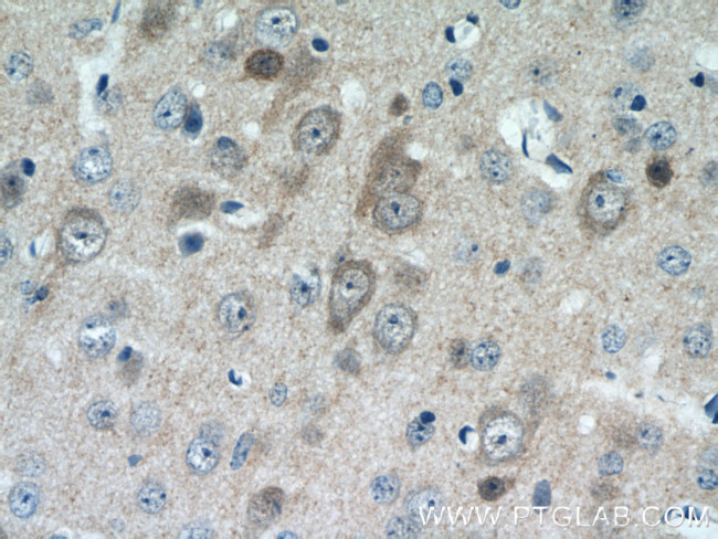 CPLX1 Antibody in Immunohistochemistry (Paraffin) (IHC (P))