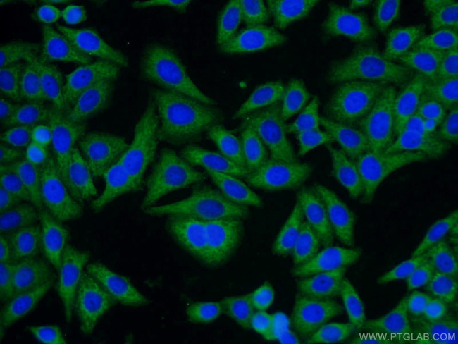 GNB1 Antibody in Immunocytochemistry (ICC/IF)