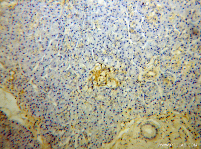 GNB1 Antibody in Immunohistochemistry (Paraffin) (IHC (P))