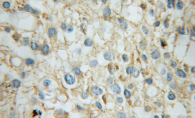 GNB1 Antibody in Immunohistochemistry (Paraffin) (IHC (P))