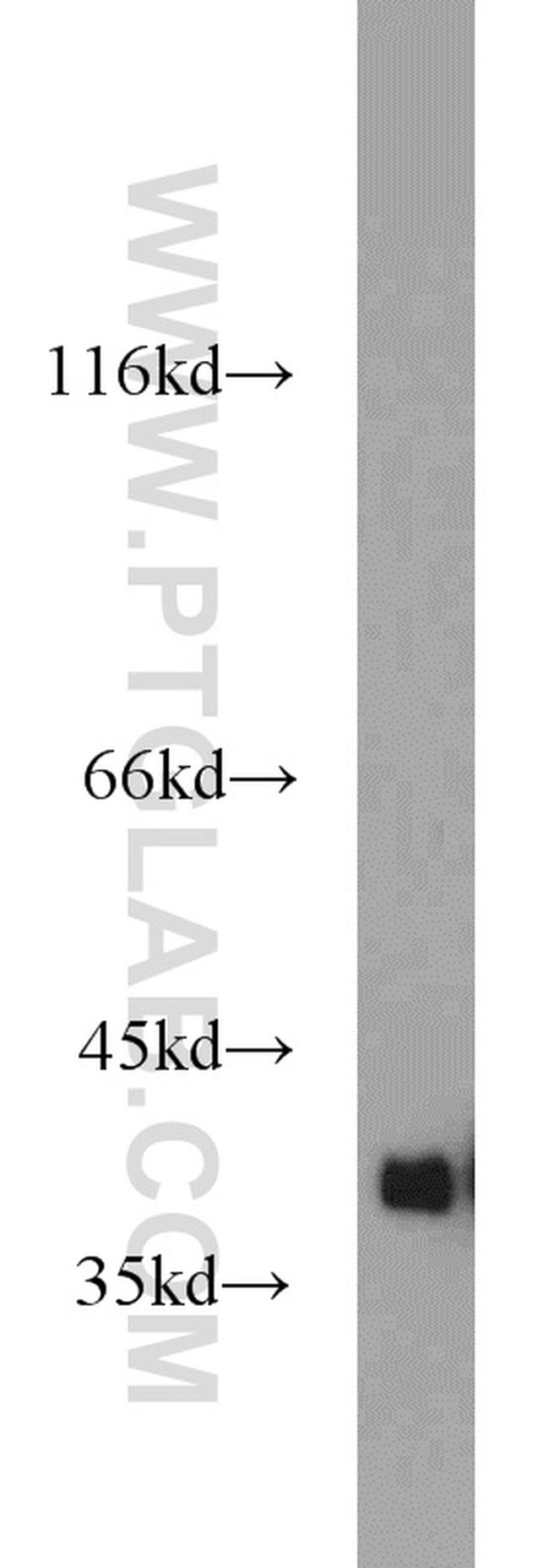 GNB1 Antibody in Western Blot (WB)