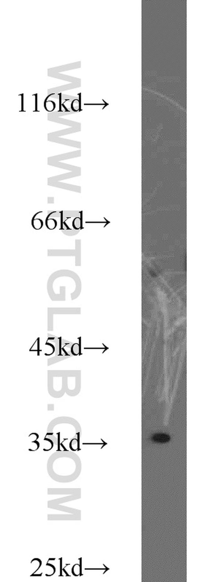 GNB1 Antibody in Western Blot (WB)