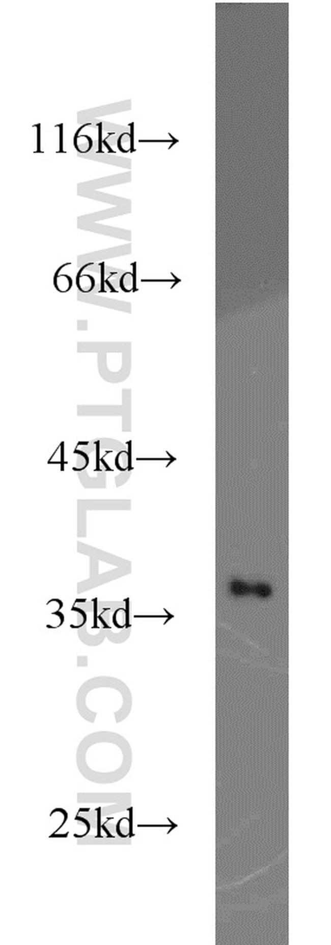 GNB1 Antibody in Western Blot (WB)