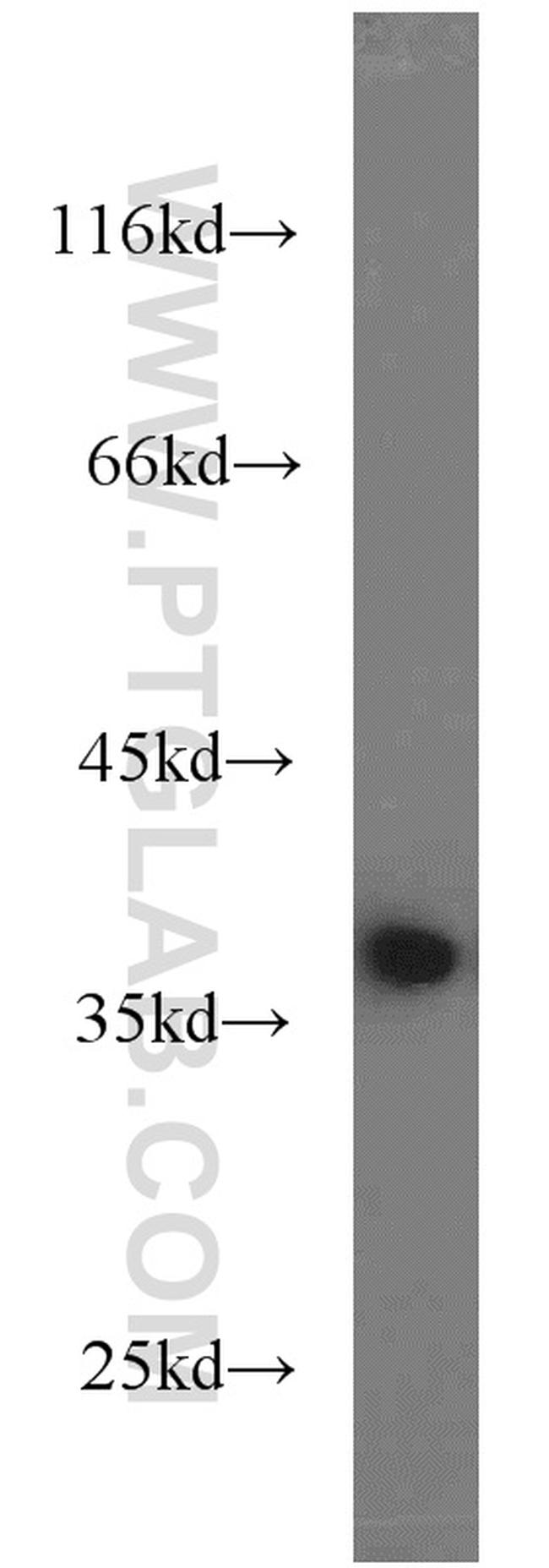 GNB1 Antibody in Western Blot (WB)