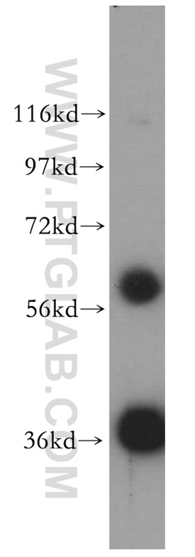 GNB1 Antibody in Western Blot (WB)