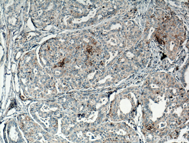 CD82 Antibody in Immunohistochemistry (Paraffin) (IHC (P))