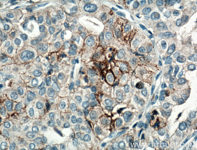 CD82 Antibody in Immunohistochemistry (Paraffin) (IHC (P))