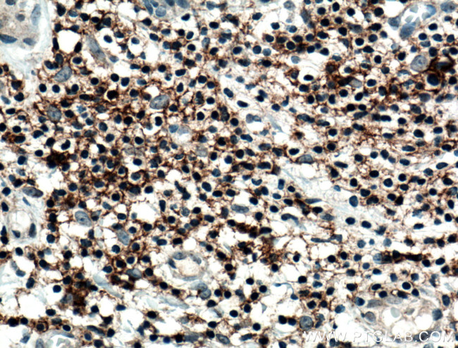 CD82 Antibody in Immunohistochemistry (Paraffin) (IHC (P))