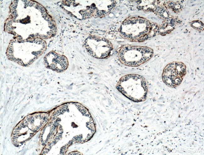 CD82 Antibody in Immunohistochemistry (Paraffin) (IHC (P))