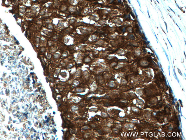 GDI1 Antibody in Immunohistochemistry (Paraffin) (IHC (P))