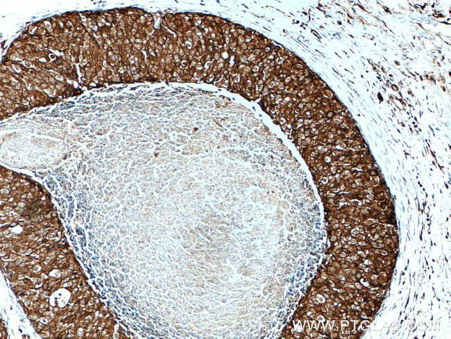 GDI1 Antibody in Immunohistochemistry (Paraffin) (IHC (P))