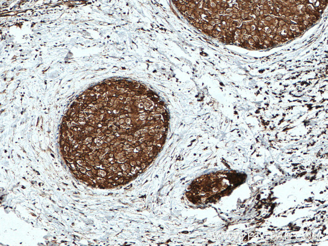 GDI1 Antibody in Immunohistochemistry (Paraffin) (IHC (P))