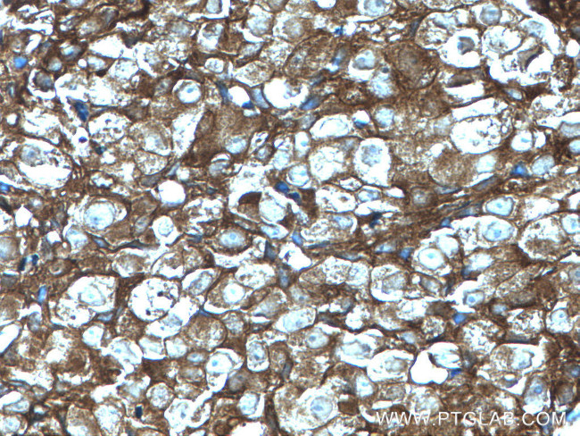 GDI1 Antibody in Immunohistochemistry (Paraffin) (IHC (P))