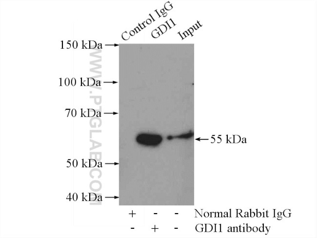 GDI1 Antibody in Immunoprecipitation (IP)