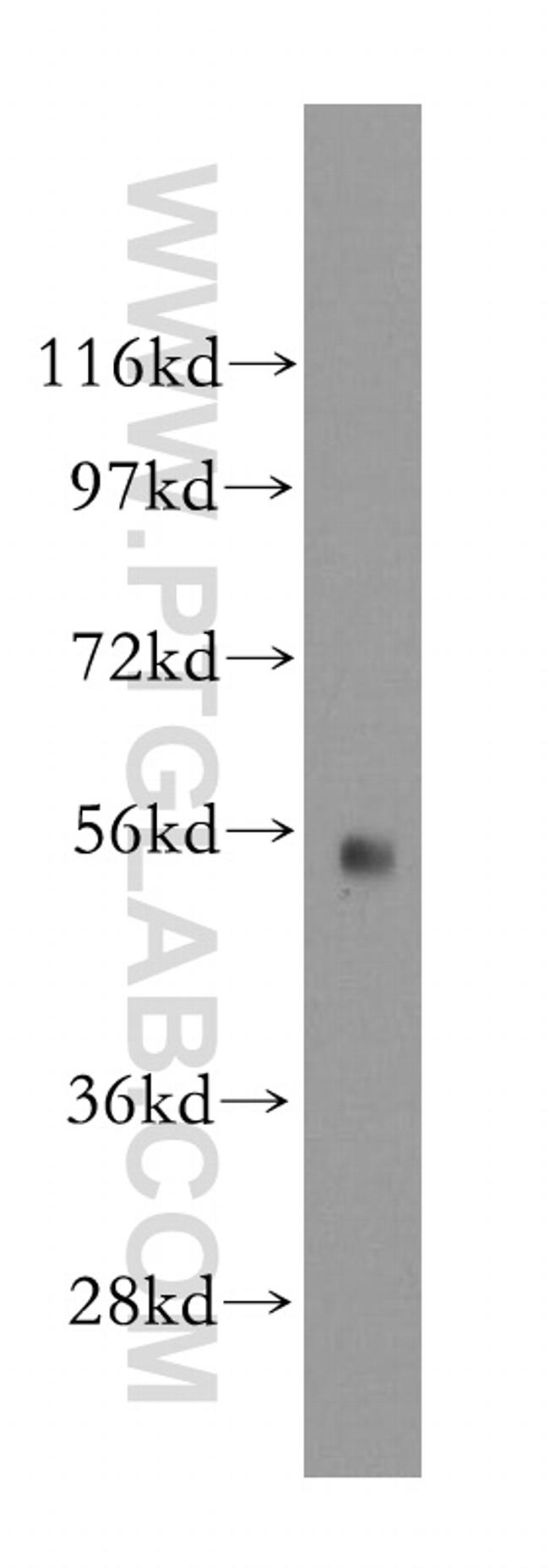 GDI1 Antibody in Western Blot (WB)