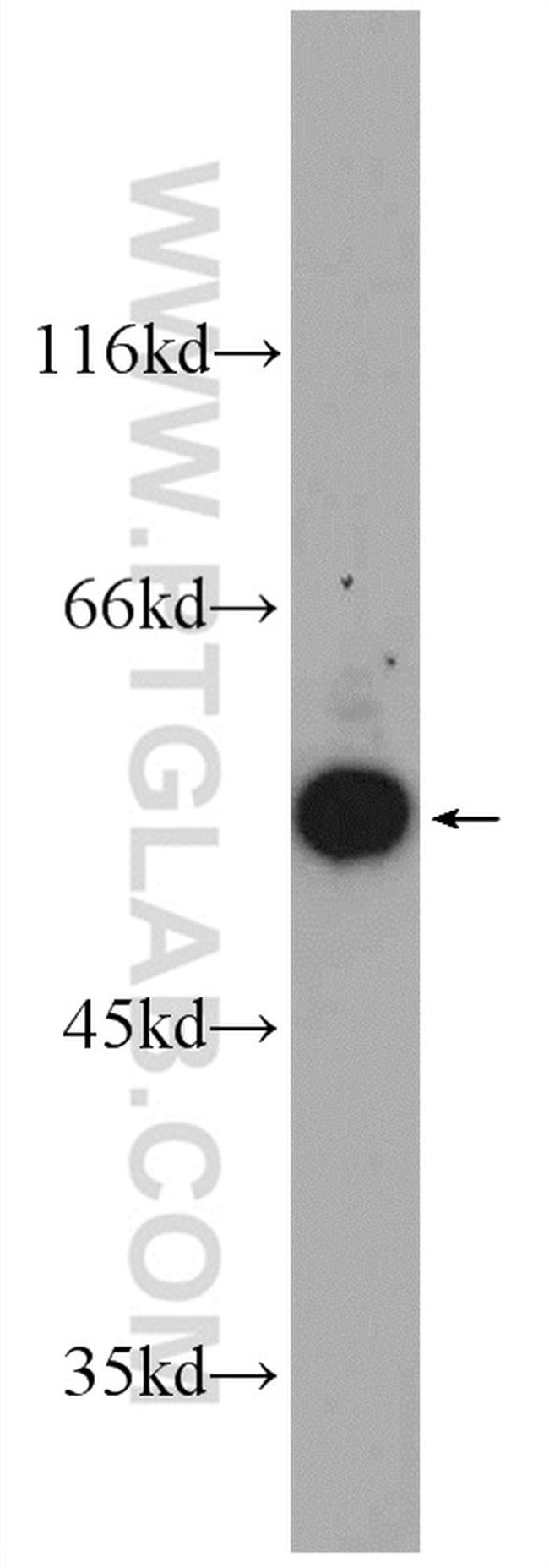 GDI1 Antibody in Western Blot (WB)