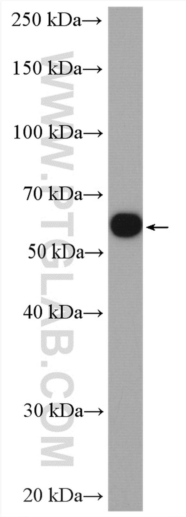 GDI1 Antibody in Western Blot (WB)