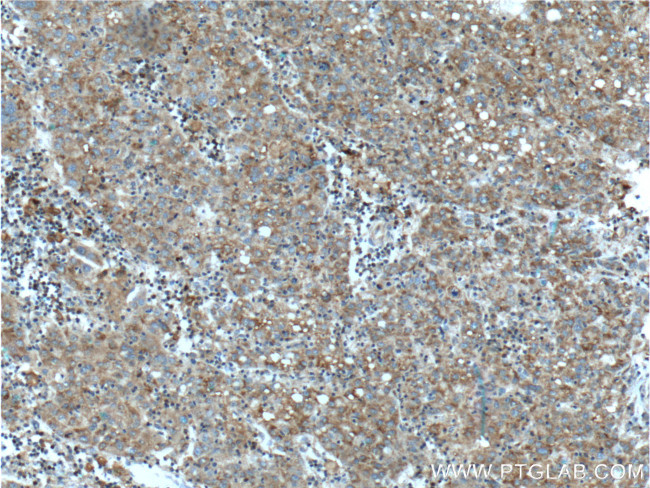 TIP30 Antibody in Immunohistochemistry (Paraffin) (IHC (P))