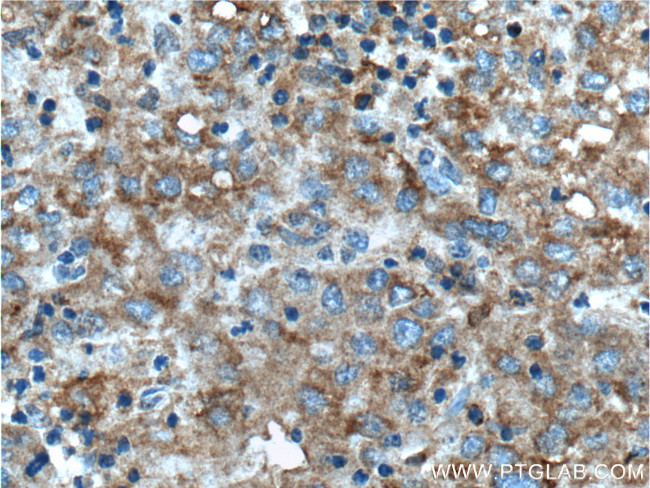 TIP30 Antibody in Immunohistochemistry (Paraffin) (IHC (P))