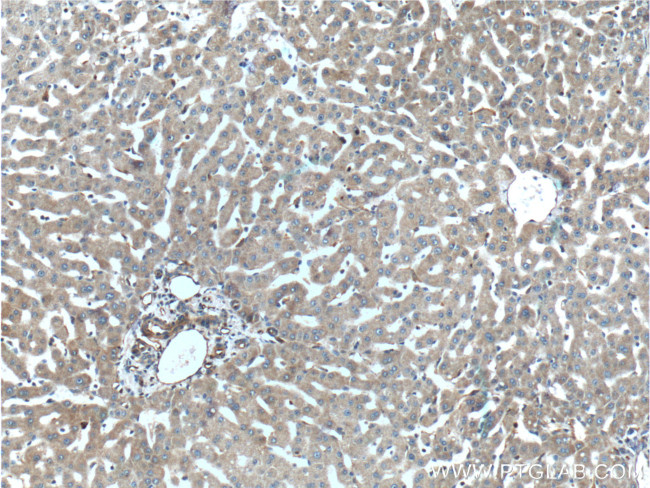 TIP30 Antibody in Immunohistochemistry (Paraffin) (IHC (P))