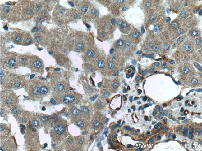 TIP30 Antibody in Immunohistochemistry (Paraffin) (IHC (P))