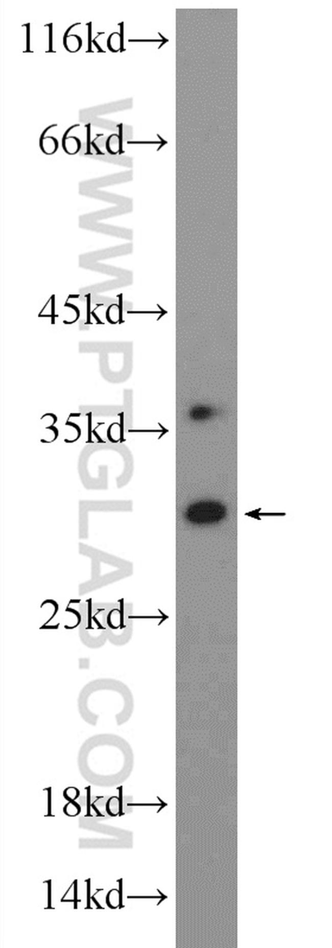 TIP30 Antibody in Western Blot (WB)