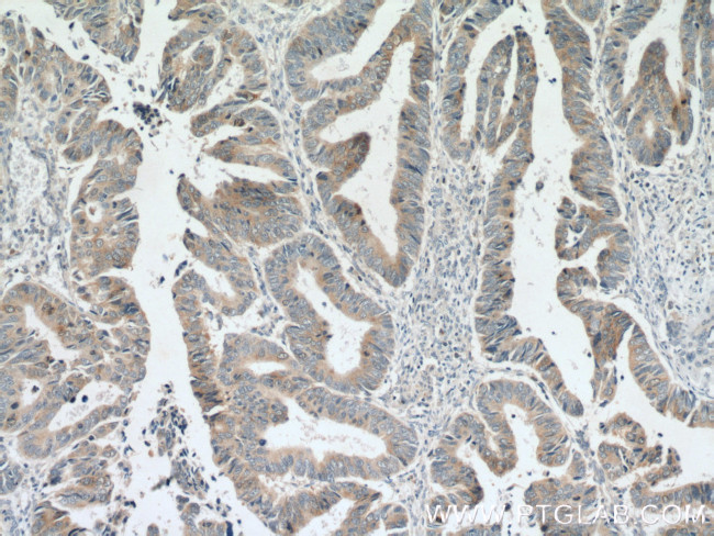 Cdc20 Antibody in Immunohistochemistry (Paraffin) (IHC (P))