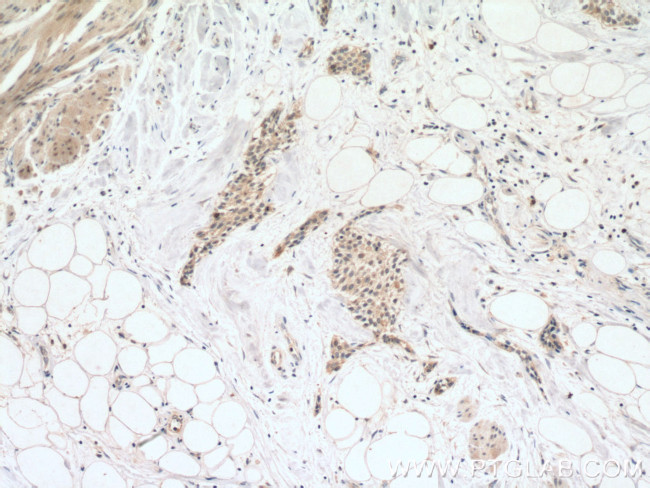 Cdc20 Antibody in Immunohistochemistry (Paraffin) (IHC (P))