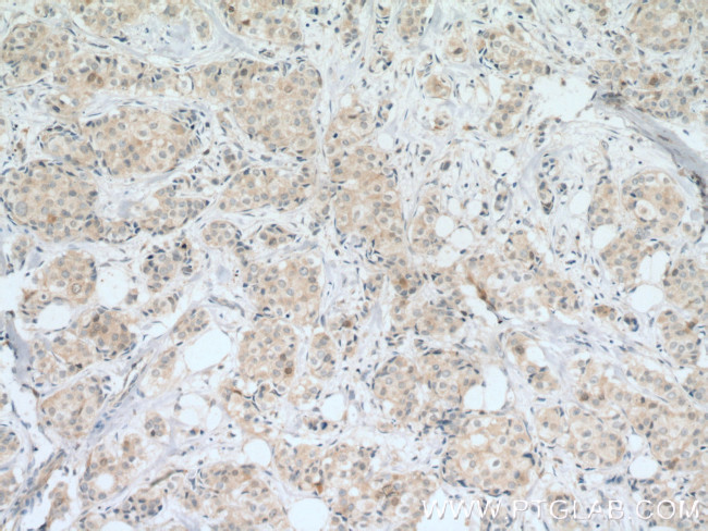 Cdc20 Antibody in Immunohistochemistry (Paraffin) (IHC (P))