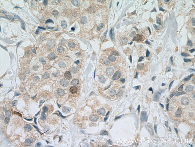 Cdc20 Antibody in Immunohistochemistry (Paraffin) (IHC (P))