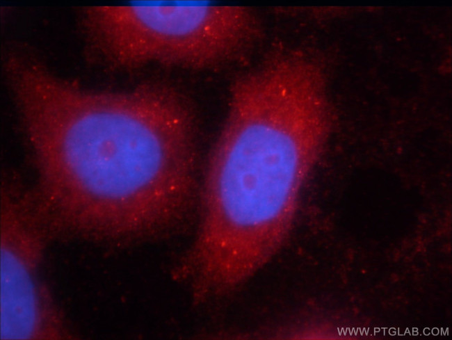 STAT3 Antibody in Immunocytochemistry (ICC/IF)