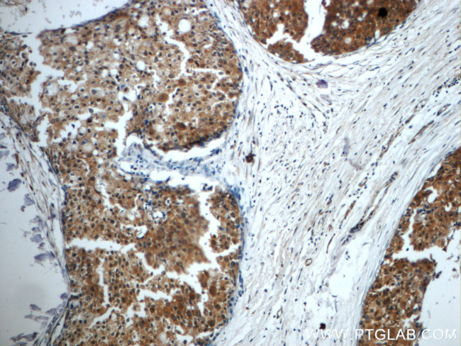 STAT3 Antibody in Immunohistochemistry (Paraffin) (IHC (P))