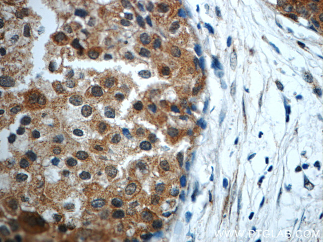 STAT3 Antibody in Immunohistochemistry (Paraffin) (IHC (P))