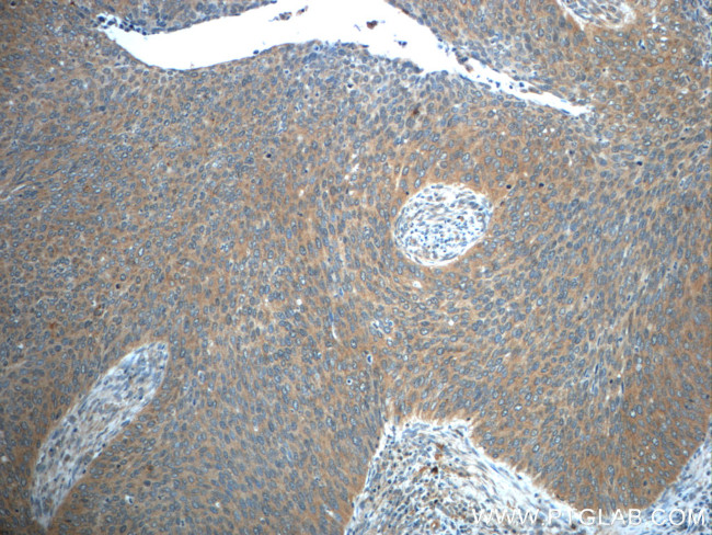 STAT3 Antibody in Immunohistochemistry (Paraffin) (IHC (P))