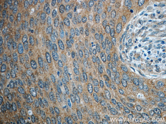 STAT3 Antibody in Immunohistochemistry (Paraffin) (IHC (P))