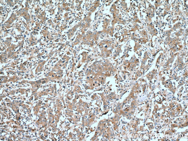 STAT3 Antibody in Immunohistochemistry (Paraffin) (IHC (P))