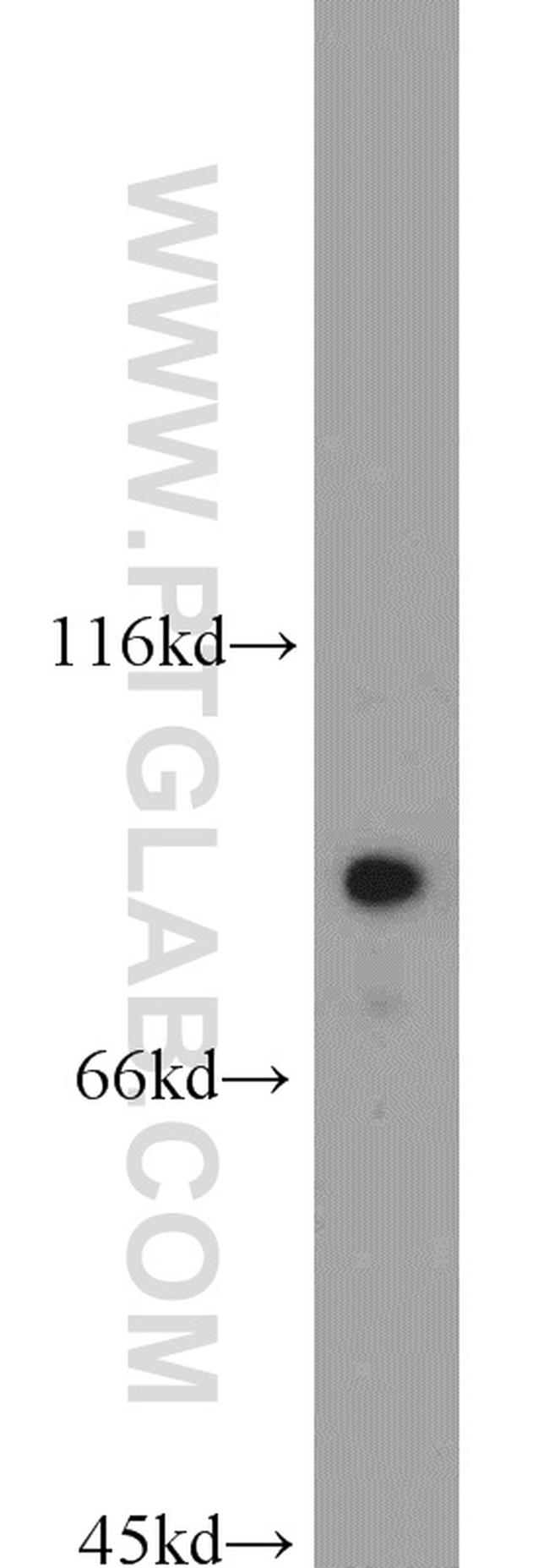 STAT3 Antibody in Western Blot (WB)