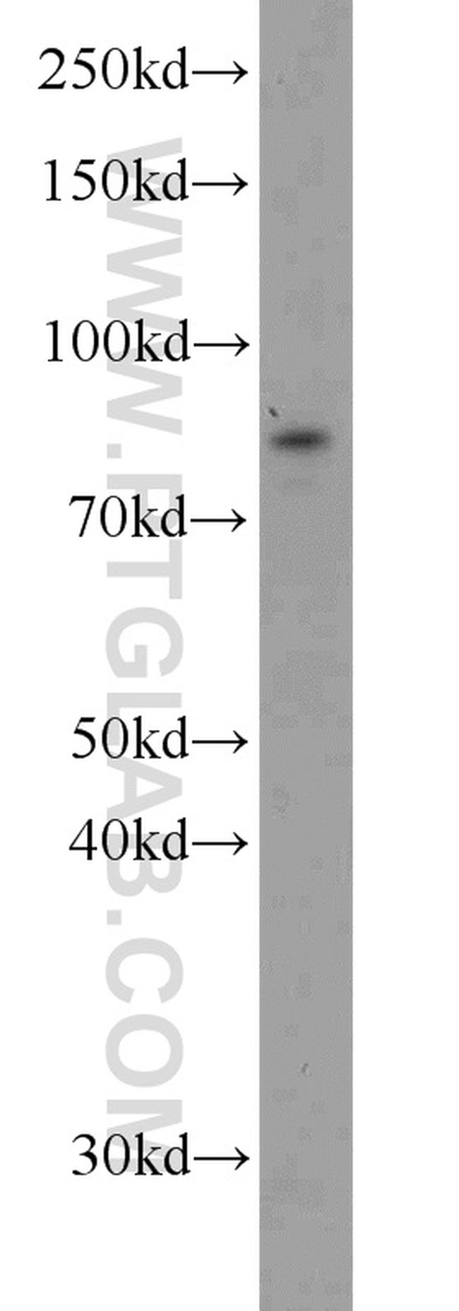 STAT3 Antibody in Western Blot (WB)