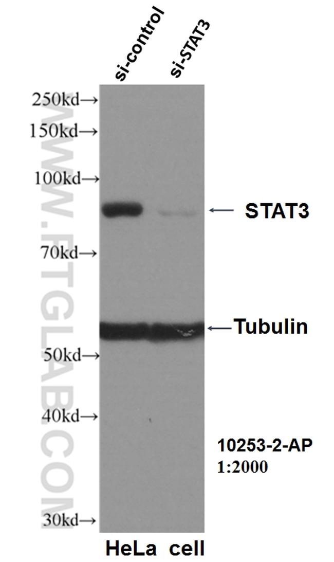 STAT3 Antibody in Western Blot (WB)