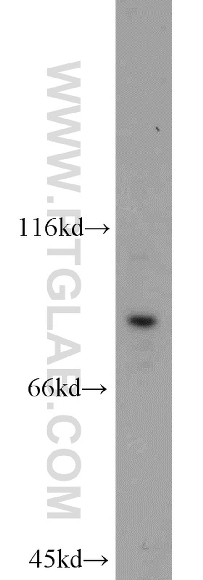 STAT3 Antibody in Western Blot (WB)