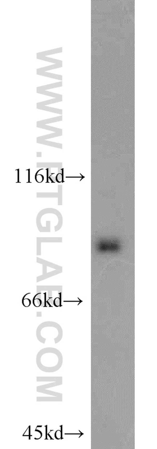 STAT3 Antibody in Western Blot (WB)