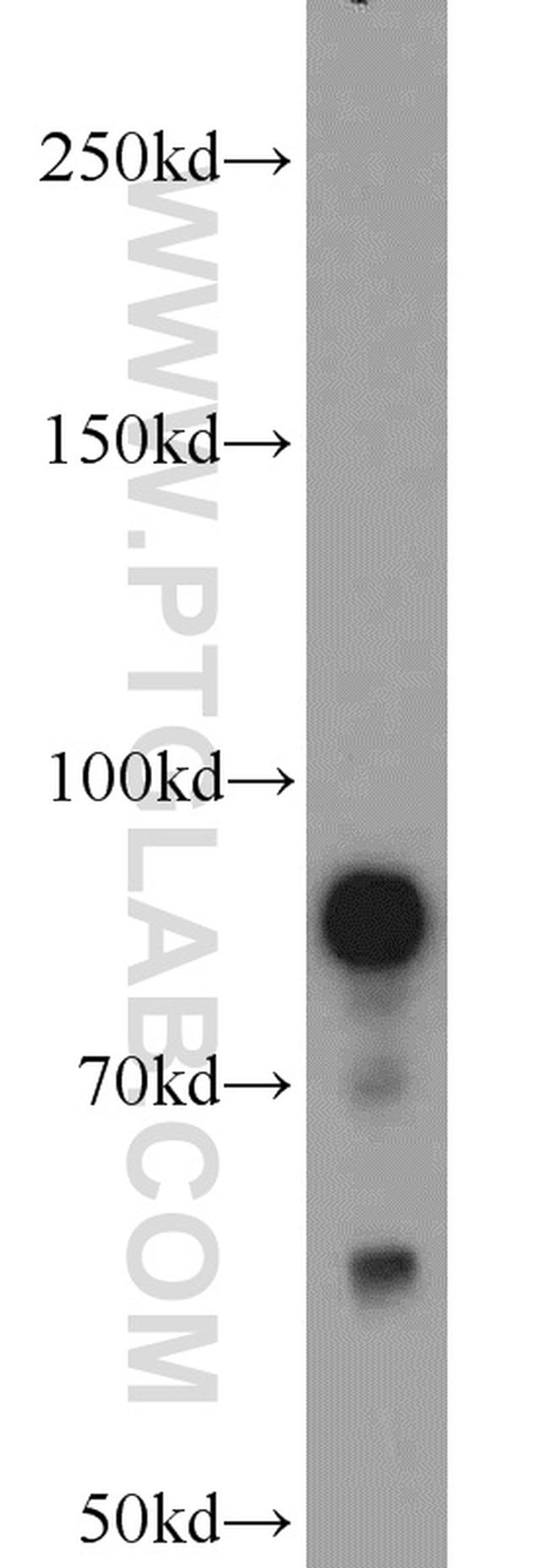 STAT3 Antibody in Western Blot (WB)