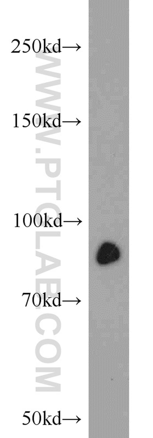 STAT3 Antibody in Western Blot (WB)