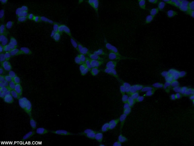 GRB2 Antibody in Immunocytochemistry (ICC/IF)