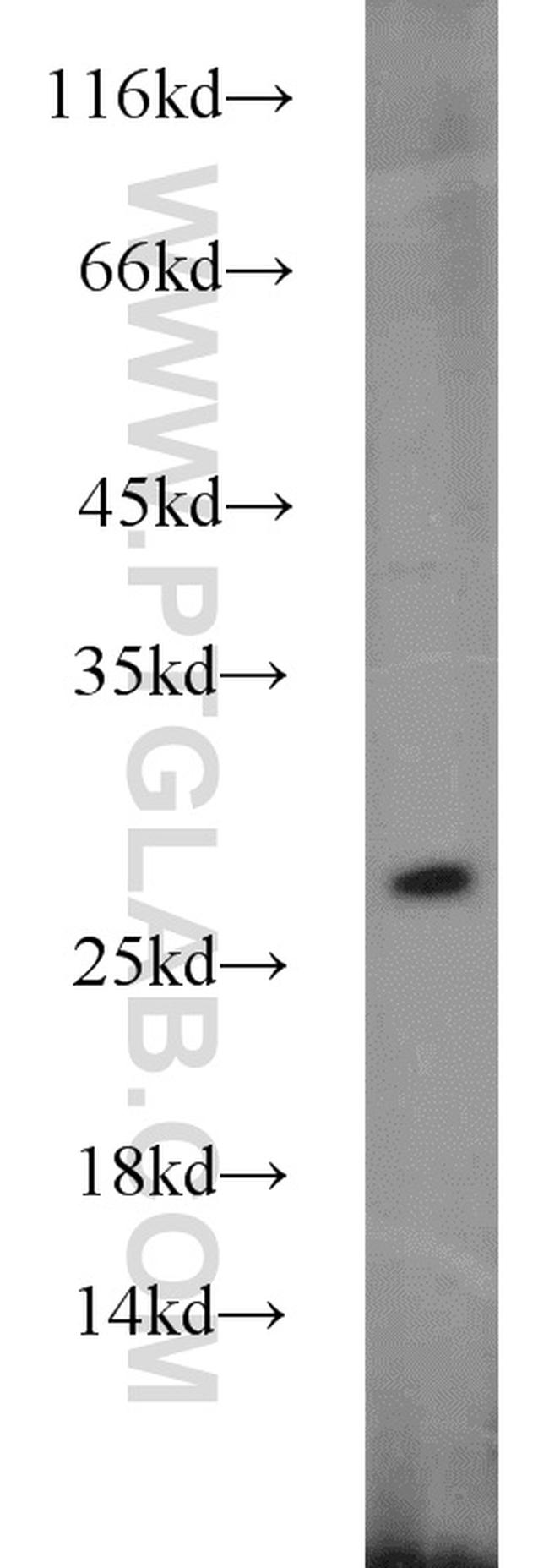 GRB2 Antibody in Western Blot (WB)