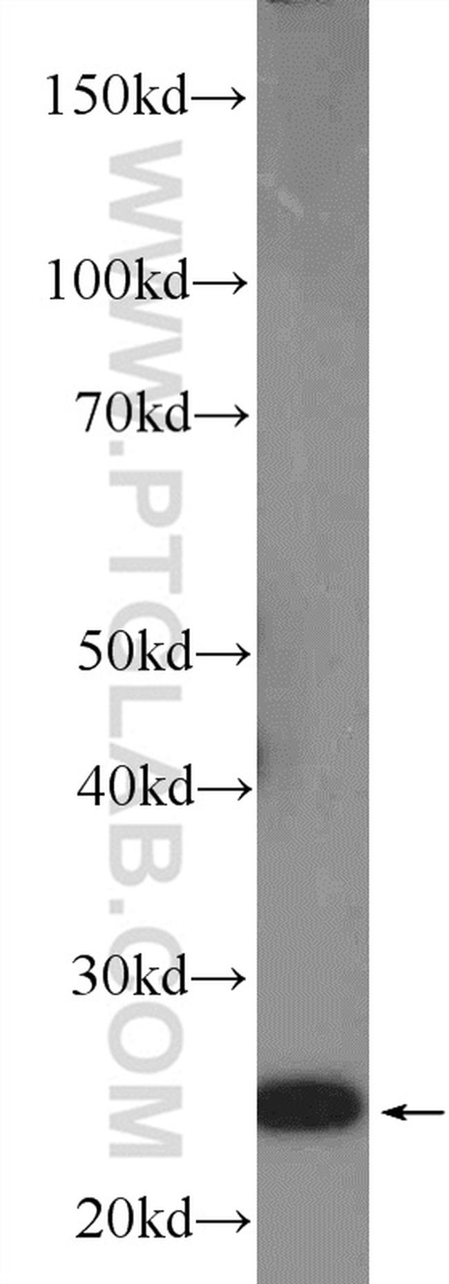 GRB2 Antibody in Western Blot (WB)